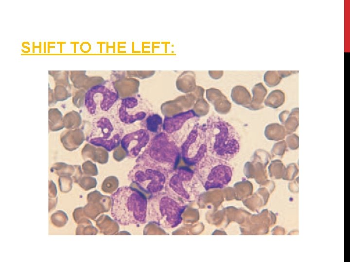 SHIFT TO THE LEFT: 