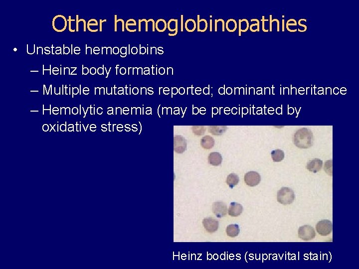 Other hemoglobinopathies • Unstable hemoglobins – Heinz body formation – Multiple mutations reported; dominant