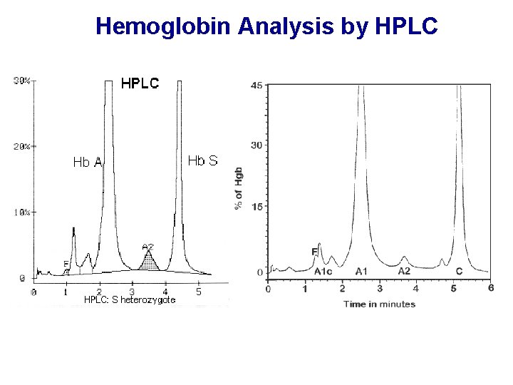Hemoglobin Analysis by HPLC 