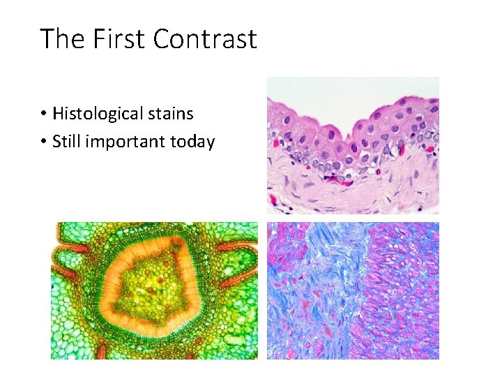 The First Contrast • Histological stains • Still important today The First Contrast • Histological stains • Still important today