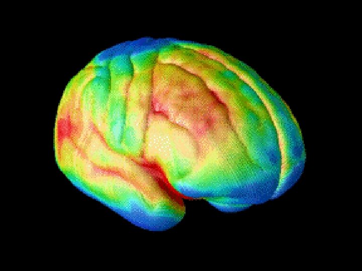 The decade-long magnetic resonance imaging (MRI) study of normal brain development, from ages 4