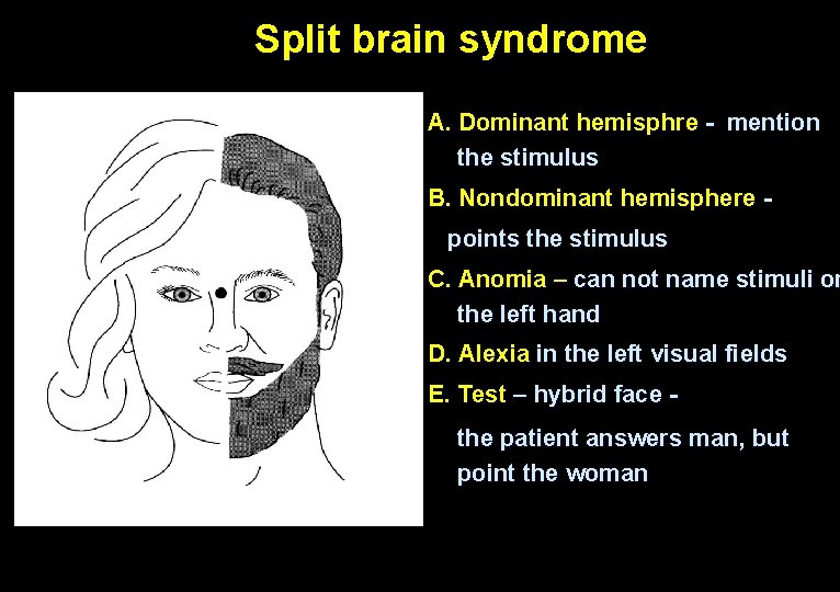 Split brain syndrome А. Dominant hemisphre - mention the stimulus B. Nondominant hemisphere points