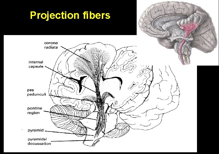 Projection fibers 