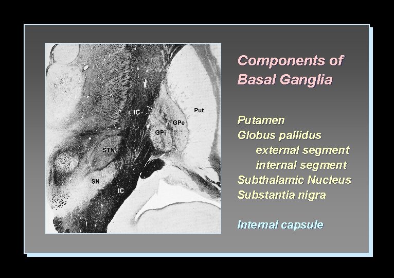 Components of Basal Ganglia Putamen Globus pallidus external segment internal segment Subthalamic Nucleus Substantia