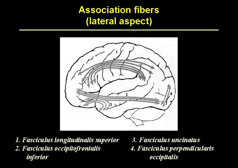 Association fibers (lateral aspect) 1. Fasciculus longitudinalis superior 2. Fasciculus occipitofrontalis inferior 3. Fasciculus