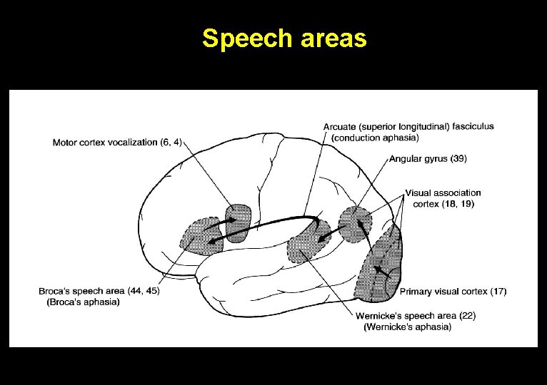 Speech areas 