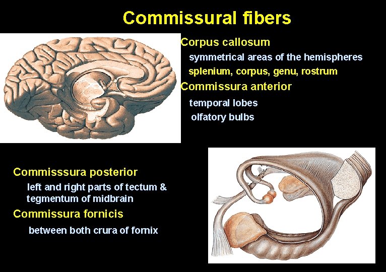 Commissural fibers Corpus callosum symmetrical areas of the hemispheres splenium, corpus, genu, rostrum Commissura