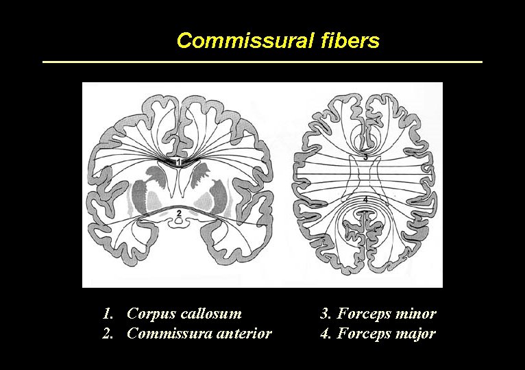 Commissural fibers 1. Corpus callosum 2. Commissura anterior 3. Forceps minor 4. Forceps major