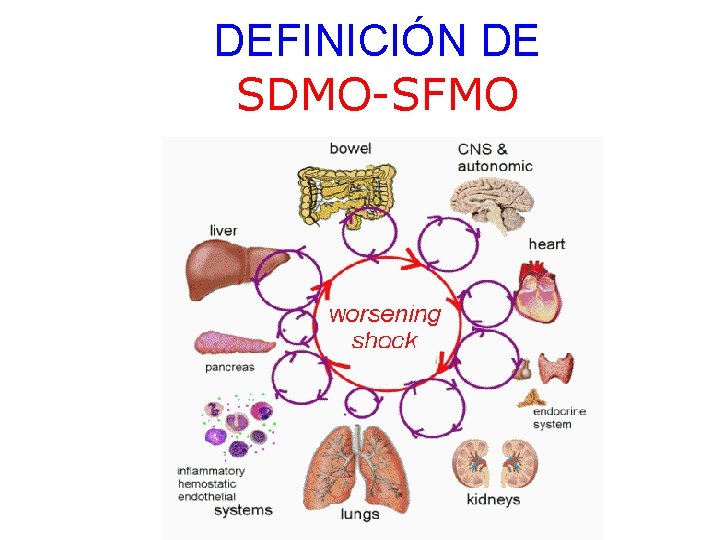 DEFINICIÓN DE SDMO-SFMO 