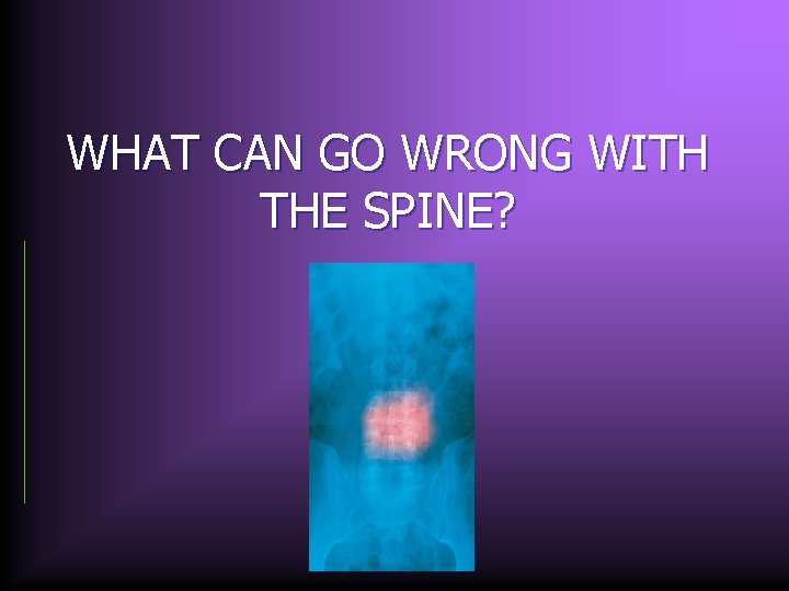 WHAT CAN GO WRONG WITH THE SPINE? 