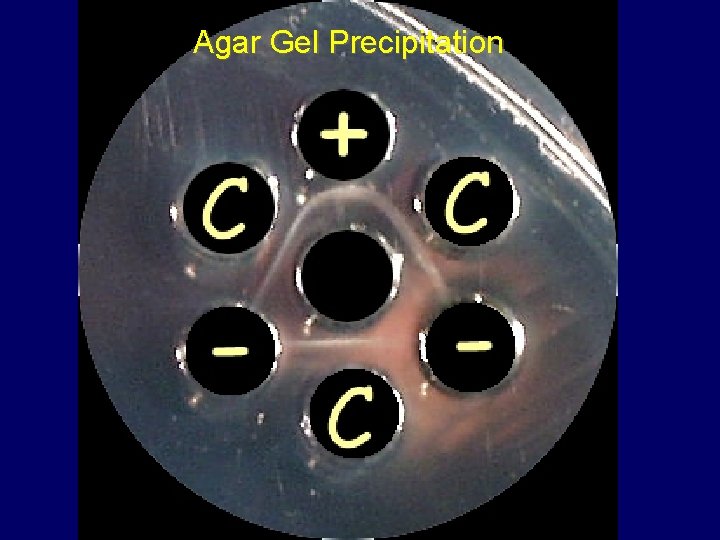 Agar Gel Precipitation 