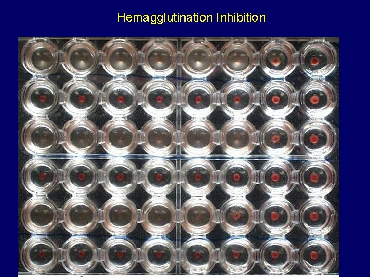 Hemagglutination Inhibition 