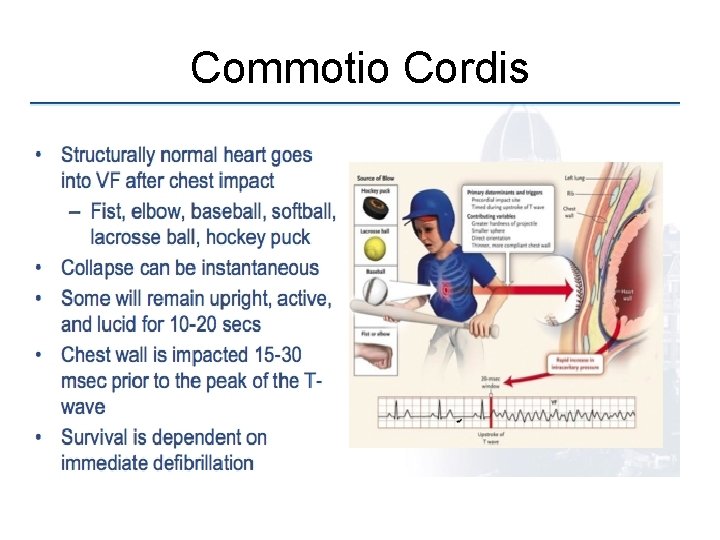 Commotio Cordis  Commotio Cordis