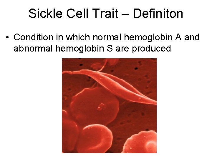 Sickle Cell Trait – Definiton • Condition in which normal hemoglobin A and abnormal Sickle Cell Trait – Definiton • Condition in which normal hemoglobin A and abnormal