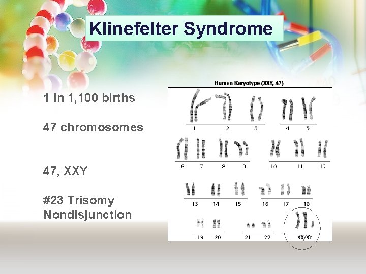 Klinefelter Syndrome 1 in 1, 100 births 47 chromosomes 47, XXY #23 Trisomy Nondisjunction Klinefelter Syndrome 1 in 1, 100 births 47 chromosomes 47, XXY #23 Trisomy Nondisjunction