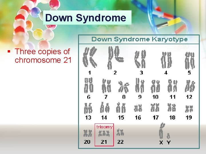 Down Syndrome § Three copies of chromosome 21 Down Syndrome § Three copies of chromosome 21