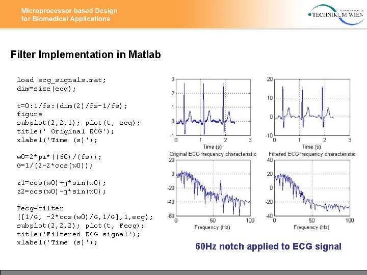 Filter Implementation in Matlab load ecg_signals. mat; dim=size(ecg); t=0: 1/fs: (dim(2)/fs-1/fs); figure subplot(2, 2,