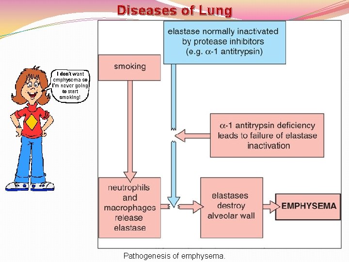 Diseases of Lung Pathogenesis of emphysema. 