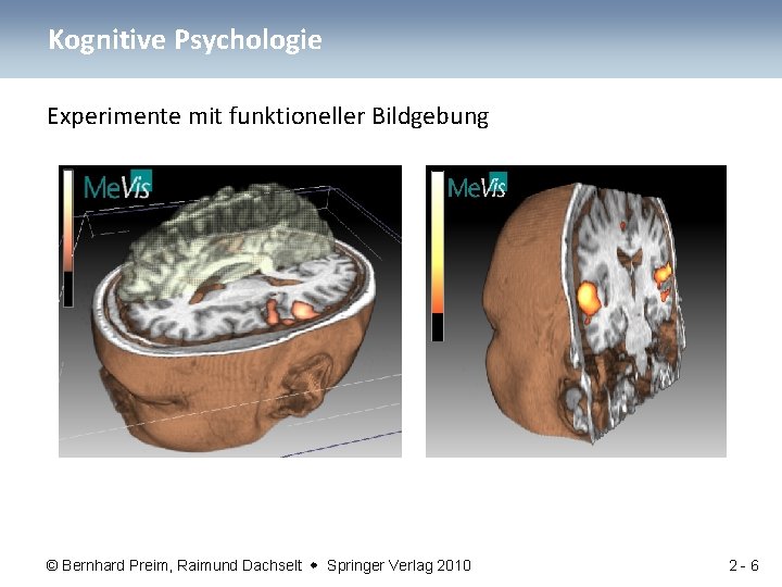 Kognitive Psychologie Experimente mit funktioneller Bildgebung © Bernhard Preim, Raimund Dachselt Springer Verlag 2010