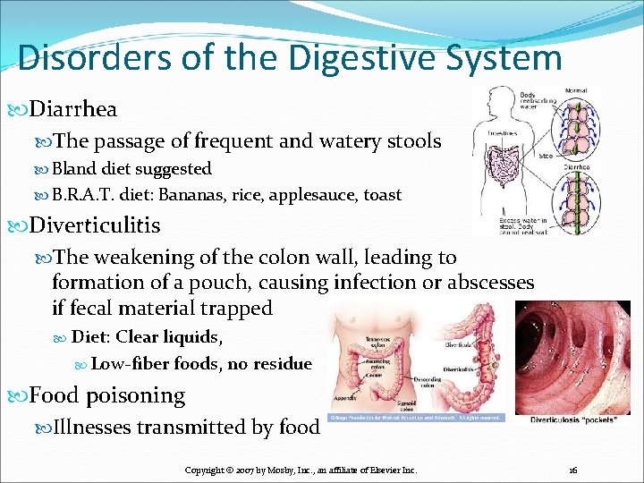 Disorders of the Digestive System Diarrhea The passage of frequent and watery stools Bland