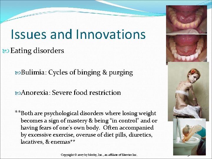 Issues and Innovations Eating disorders Bulimia: Cycles of binging & purging Anorexia: Severe food