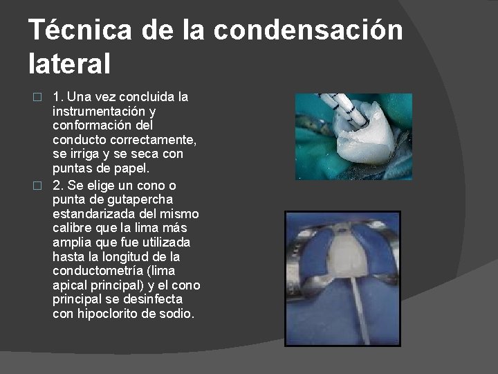 Técnica de la condensación lateral 1. Una vez concluida la instrumentación y conformación del