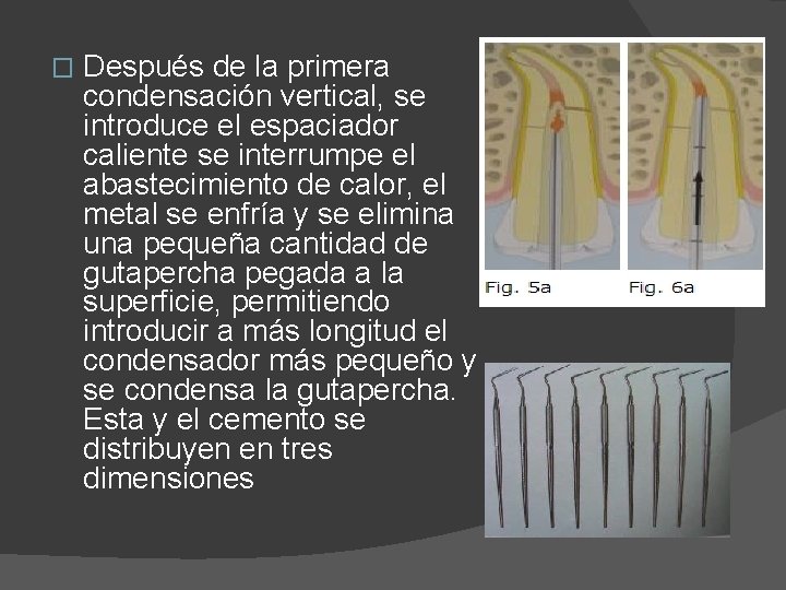 � Después de la primera condensación vertical, se introduce el espaciador caliente se interrumpe