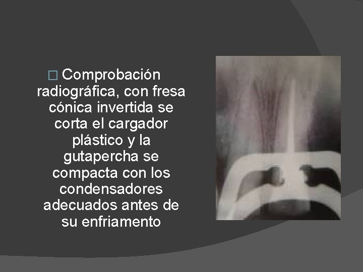 � Comprobación radiográfica, con fresa cónica invertida se corta el cargador plástico y la