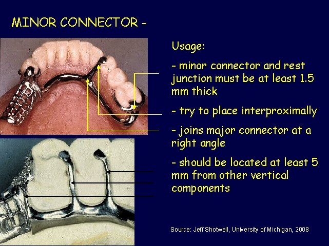 MINOR CONNECTOR Usage: - minor connector and rest junction must be at least 1.