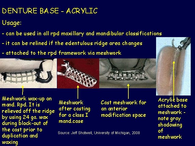 DENTURE BASE - ACRYLIC Usage: - can be used in all rpd maxillary and