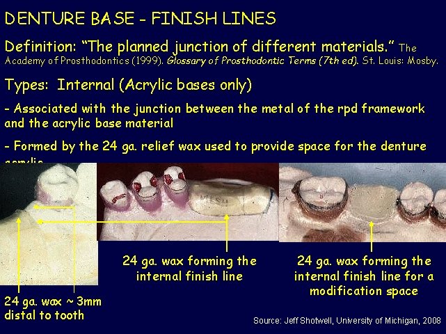 DENTURE BASE - FINISH LINES Definition: “The planned junction of different materials. ” The
