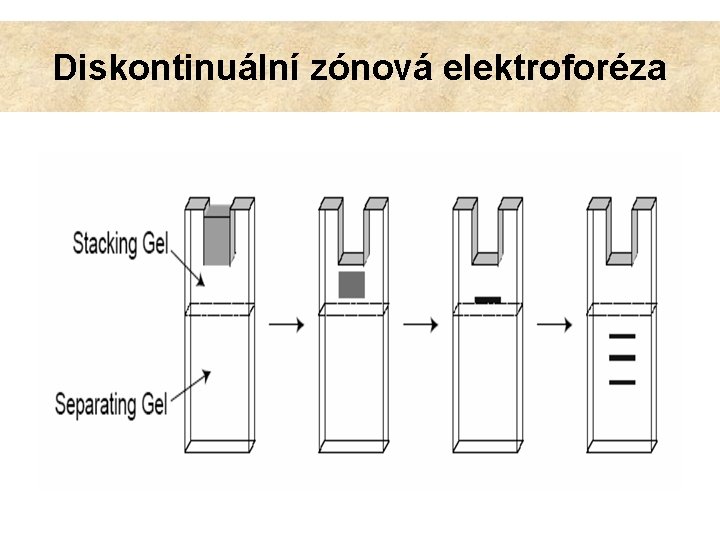 Diskontinuální zónová elektroforéza 
