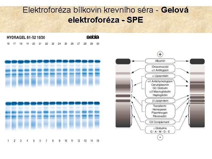 Elektroforéza bílkovin krevního séra - Gelová elektroforéza - SPE 