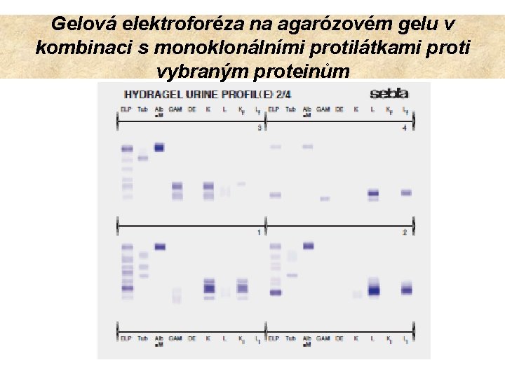 Gelová elektroforéza na agarózovém gelu v kombinaci s monoklonálními protilátkami proti vybraným proteinům 