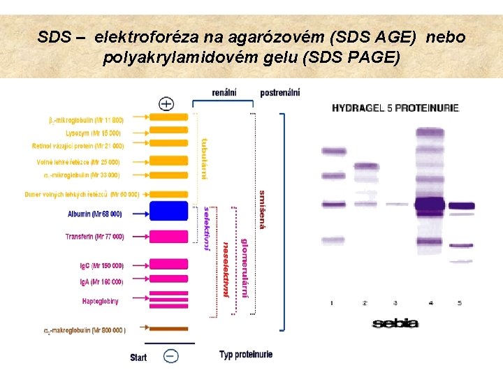 SDS – elektroforéza na agarózovém (SDS AGE) nebo polyakrylamidovém gelu (SDS PAGE) 