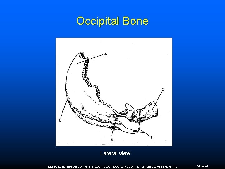 Occipital Bone Lateral view Mosby items and derived items © 2007, 2003, 1999 by