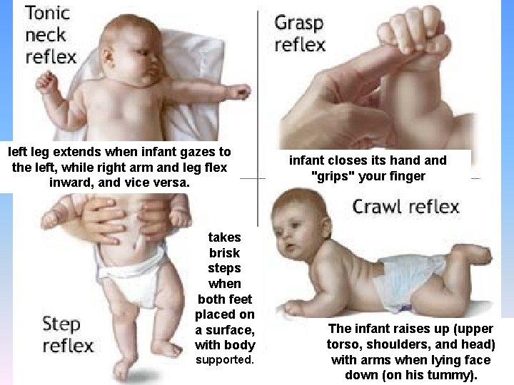 left leg extends when infant gazes to the left, while right arm and leg