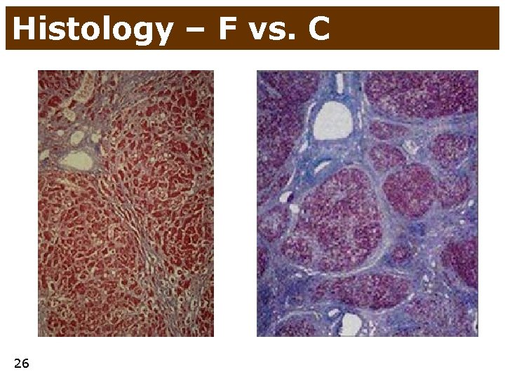 Histology – F vs. C 26 