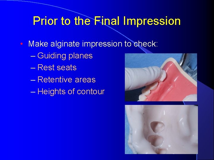 Prior to the Final Impression • Make alginate impression to check: – Guiding planes