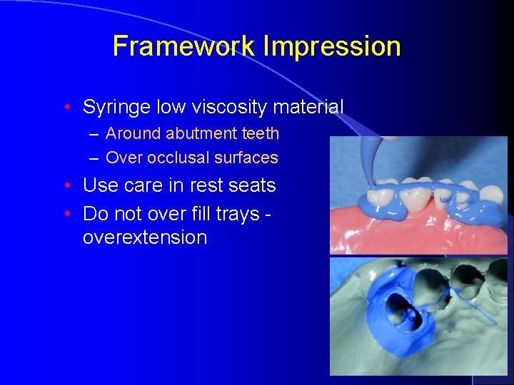 Framework Impression • Syringe low viscosity material – Around abutment teeth – Over occlusal