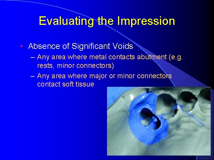 Evaluating the Impression • Absence of Significant Voids – Any area where metal contacts