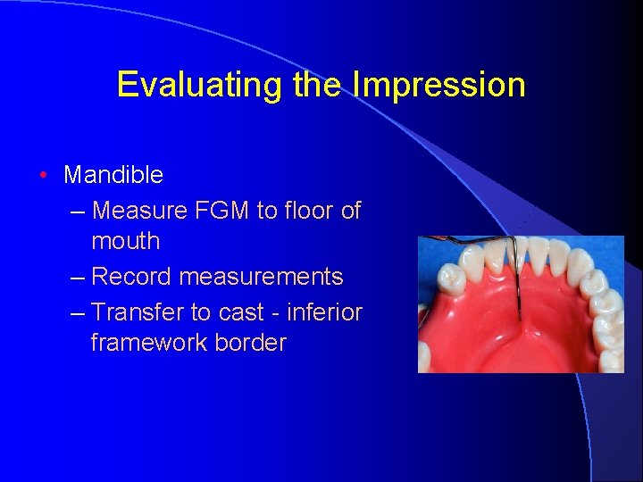 Evaluating the Impression • Mandible – Measure FGM to floor of mouth – Record