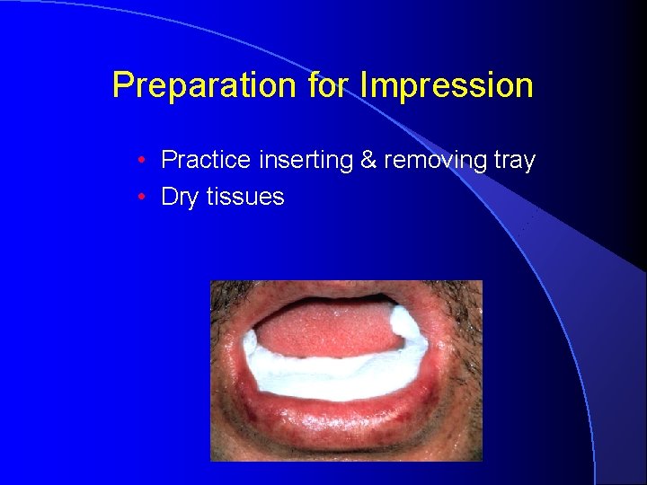 Preparation for Impression • Practice inserting & removing tray • Dry tissues 