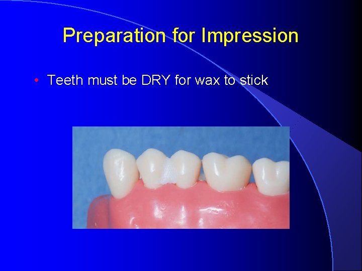 Preparation for Impression • Teeth must be DRY for wax to stick 