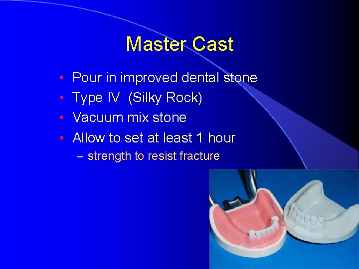 Master Cast • • Pour in improved dental stone Type IV (Silky Rock) Vacuum