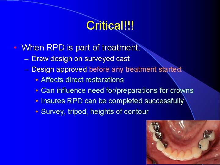 Critical!!! • When RPD is part of treatment: – Draw design on surveyed cast