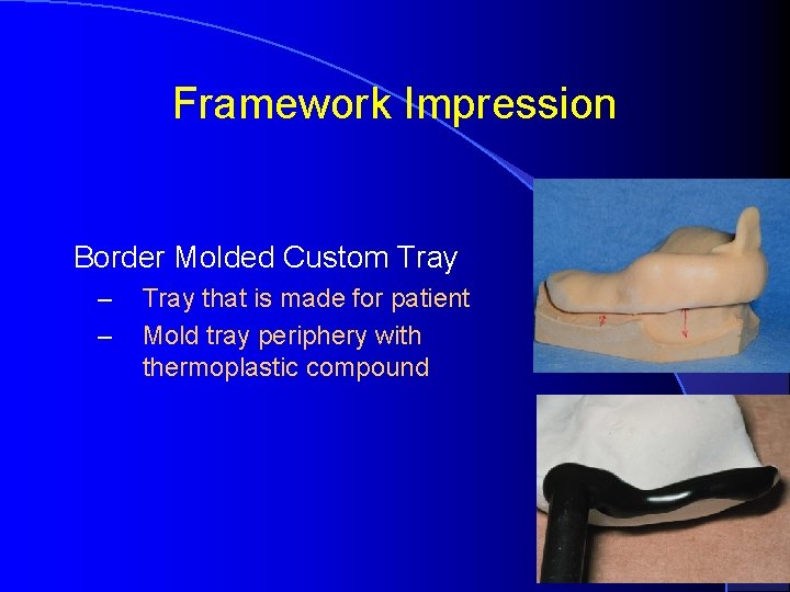Framework Impression Border Molded Custom Tray – – Tray that is made for patient