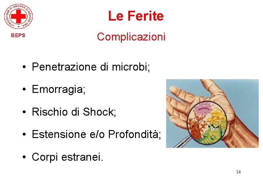 Le Ferite BEPS Complicazioni • Penetrazione di microbi; • Emorragia; • Rischio di Shock;