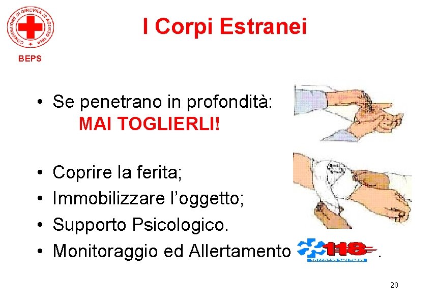 I Corpi Estranei BEPS • Se penetrano in profondità: MAI TOGLIERLI! • • Coprire