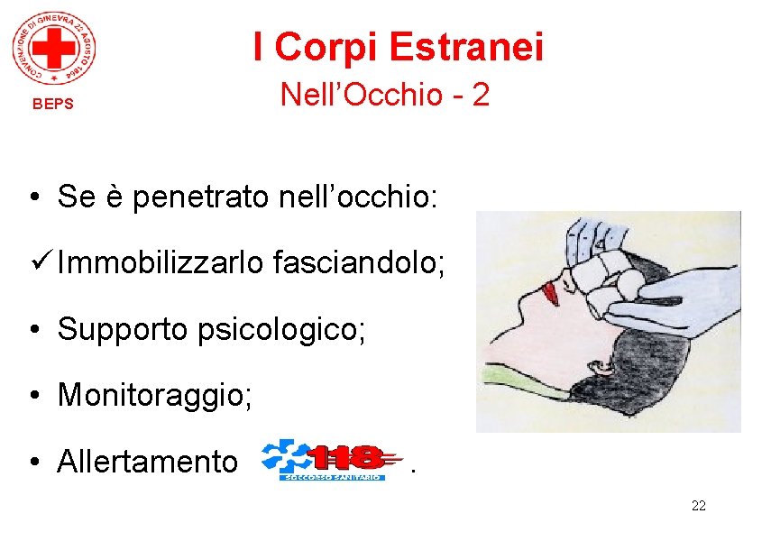 I Corpi Estranei BEPS Nell’Occhio - 2 • Se è penetrato nell’occhio: ü Immobilizzarlo